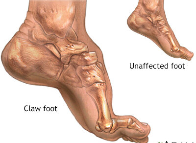 Claw Foot Sağlık Sorunları ve Kesin Çözümler [2026 Uzman Rehberi] - Kapak Görseli