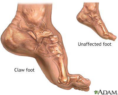 Claw Foot Sağlık Sorunları ve Kesin Çözümler [2026 Uzman Rehberi] - Kapak Görseli